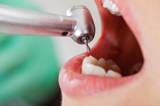 Best Emergency Dental Care for Broken or Chipped Teeth in Phoenixville, PA